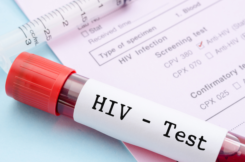 πώς να μεταδώσει τον ιό HIV