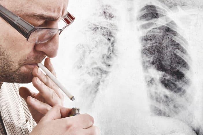συμπτώματα καρκίνου του πνεύμονα