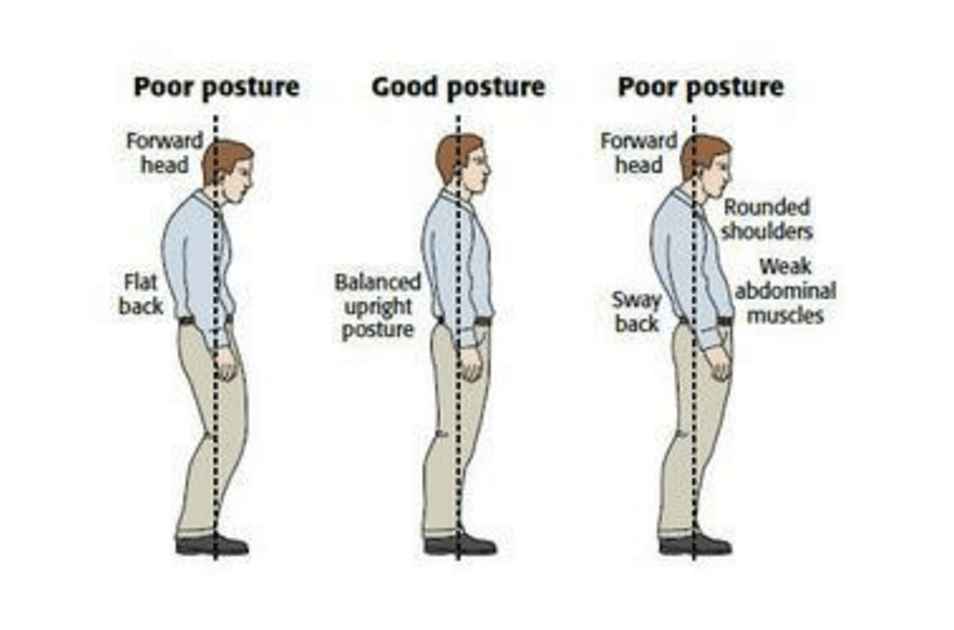 Πηγή εικόνας: http://www.thephysiocompany.com/blog/stop-slouching-postural-dysfunction-symptoms-causes-and-treatment-of-bad-posture