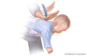 Βήματα για να βοηθήσετε να πνιγούν τα μωρά (1-3) πηγές: www.webmd.com