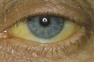 κίτρινα μάτια