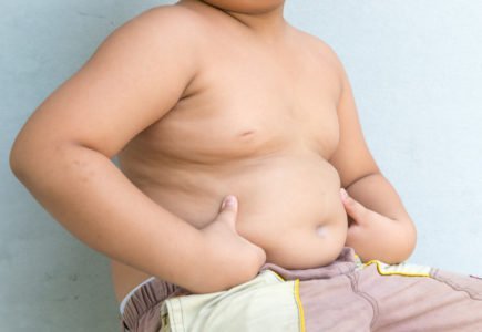 παχυσαρκία στα παιδιά