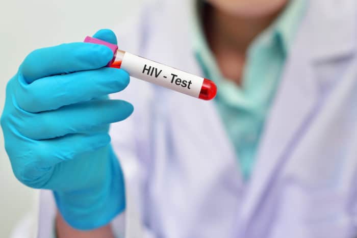 Δοκιμή αίματος HIV
